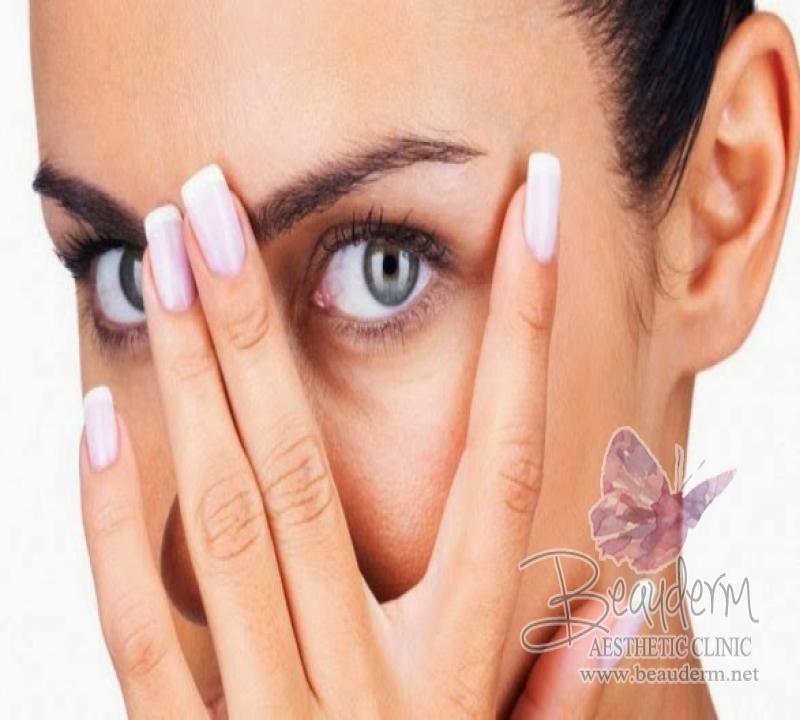 Atasi Mata Cekung Dan Hitam Secara Instan Tanpa Pembedahan